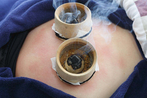 艾灸期间可以游泳吗